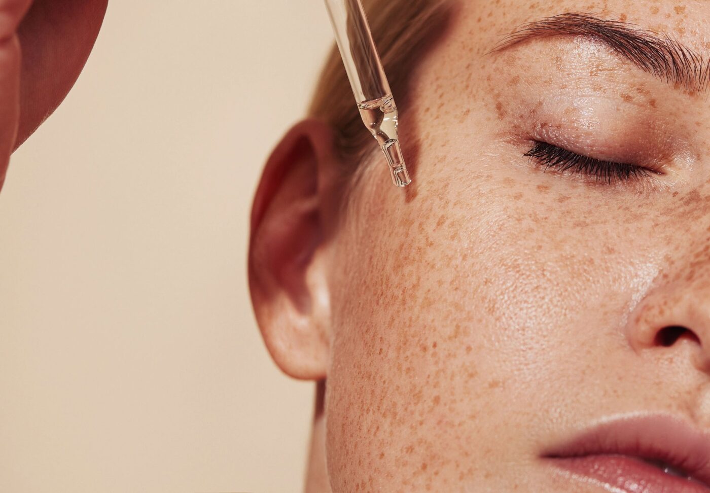 Close-up of a person with freckles applying a clear facial oil with a dropper.